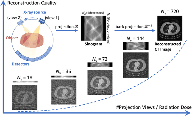 Figure 1 for Learning to Distill Global Representation for Sparse-View CT