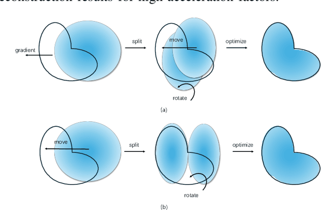 Figure 2 for Three-Dimensional MRI Reconstruction with Gaussian Representations: Tackling the Undersampling Problem