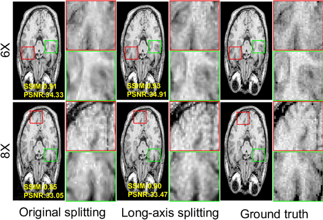 Figure 4 for Three-Dimensional MRI Reconstruction with Gaussian Representations: Tackling the Undersampling Problem