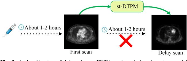 Figure 1 for st-DTPM: Spatial-Temporal Guided Diffusion Transformer Probabilistic Model for Delayed Scan PET Image Prediction