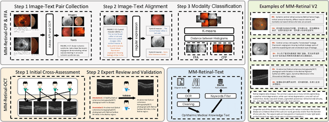 Figure 2 for MM-Retinal V2: Transfer an Elite Knowledge Spark into Fundus Vision-Language Pretraining