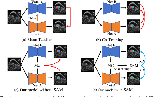 Figure 1 for Learnable Prompting SAM-induced Knowledge Distillation for Semi-supervised Medical Image Segmentation