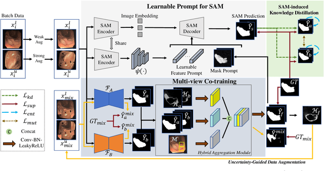 Figure 2 for Learnable Prompting SAM-induced Knowledge Distillation for Semi-supervised Medical Image Segmentation