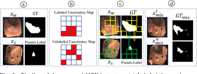 Figure 3 for Learnable Prompting SAM-induced Knowledge Distillation for Semi-supervised Medical Image Segmentation