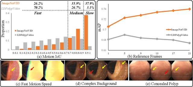 Figure 1 for YONA: You Only Need One Adjacent Reference-frame for Accurate and Fast Video Polyp Detection