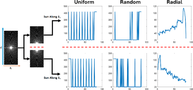 Figure 3 for On the Foundation Model for Cardiac MRI Reconstruction