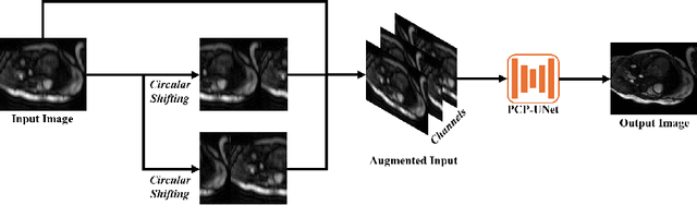 Figure 4 for On the Foundation Model for Cardiac MRI Reconstruction