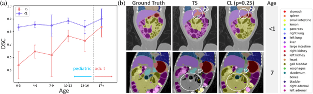 Figure 3 for Unlocking Robust Segmentation Across All Age Groups via Continual Learning