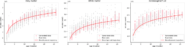 Figure 4 for Cas-DiffCom: Cascaded diffusion model for infant longitudinal super-resolution 3D medical image completion