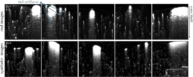 Figure 4 for Simulation-Based Segmentation of Blood Vessels in Cerebral 3D OCTA Images