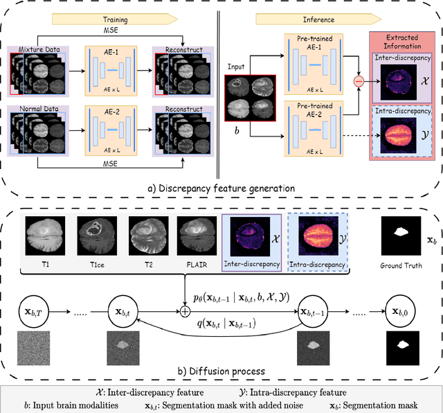 Figure 1 for Discrepancy-based Diffusion Models for Lesion Detection in Brain MRI