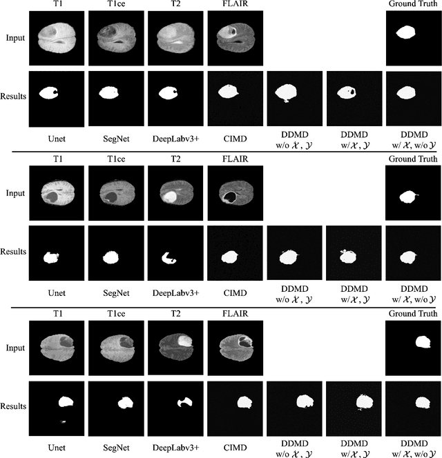 Figure 4 for Discrepancy-based Diffusion Models for Lesion Detection in Brain MRI