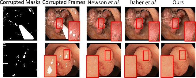 Figure 3 for Depth-Aware Endoscopic Video Inpainting