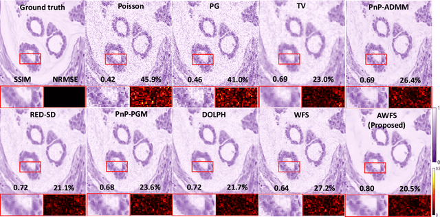 Figure 2 for AWFSD: Accelerated Wirtinger Flow with Score-based Diffusion Image Prior for Poisson-Gaussian Holographic Phase Retrieval