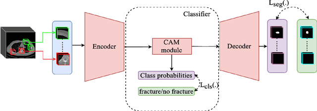 Figure 3 for Leveraging Auxiliary Classification for Rib Fracture Segmentation