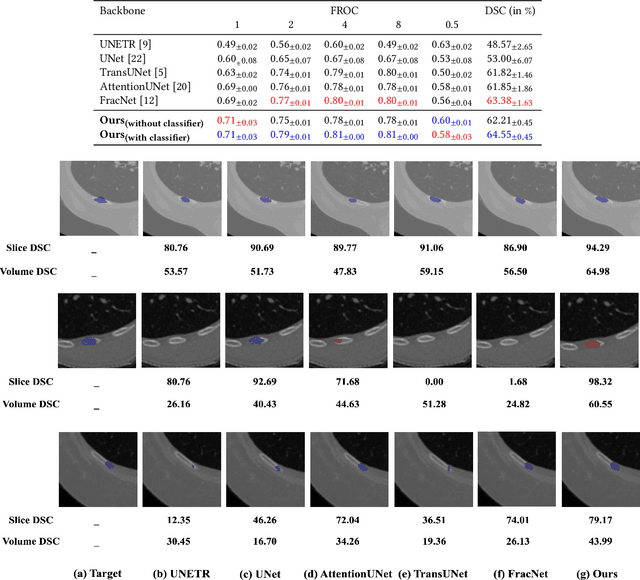 Figure 2 for Leveraging Auxiliary Classification for Rib Fracture Segmentation