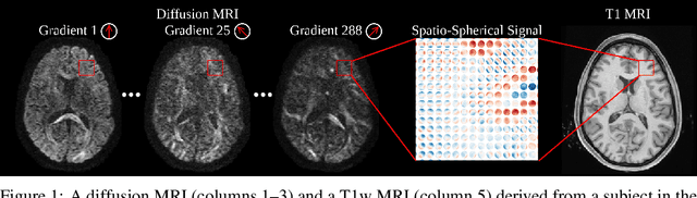 Figure 1 for Equivariant spatio-hemispherical networks for diffusion MRI deconvolution