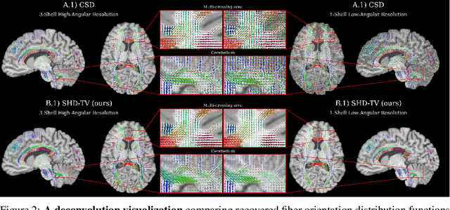 Figure 3 for Equivariant spatio-hemispherical networks for diffusion MRI deconvolution