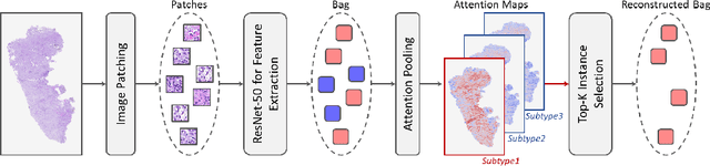 Figure 3 for Multimodal Cross-Task Interaction for Survival Analysis in Whole Slide Pathological Images