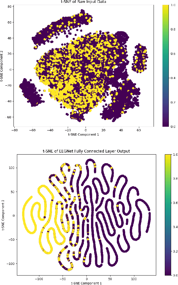 Figure 2 for Imagined Speech State Classification for Robust Brain-Computer Interface