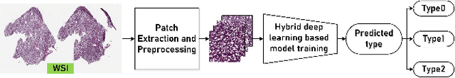 Figure 1 for Hybrid deep learning-based strategy for the hepatocellular carcinoma cancer grade classification of H&E stained liver histopathology images