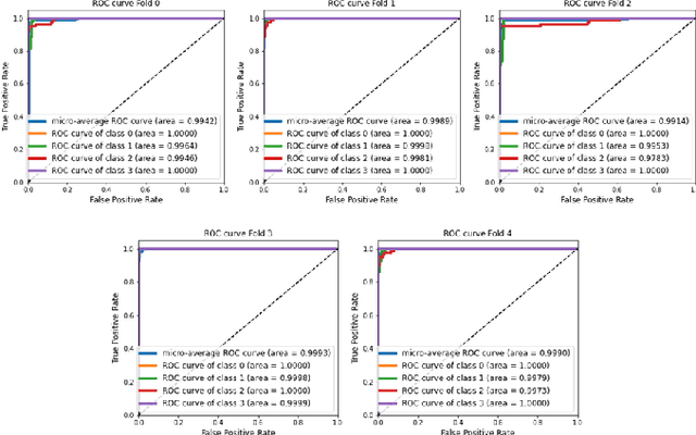 Figure 4 for Hybrid deep learning-based strategy for the hepatocellular carcinoma cancer grade classification of H&E stained liver histopathology images