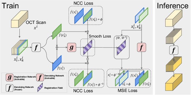 Figure 1 for Self-supervised OCT Image Denoising with Slice-to-Slice Registration and Reconstruction