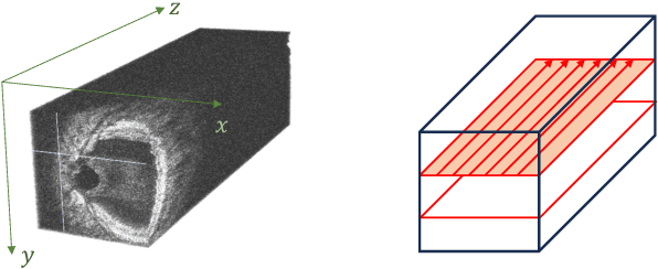 Figure 2 for Self-supervised OCT Image Denoising with Slice-to-Slice Registration and Reconstruction