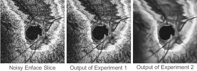 Figure 3 for Self-supervised OCT Image Denoising with Slice-to-Slice Registration and Reconstruction