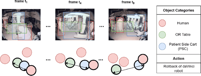 Figure 1 for ST(OR)2: Spatio-Temporal Object Level Reasoning for Activity Recognition in the Operating Room