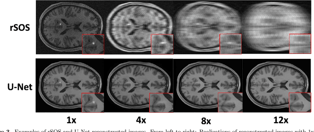 Figure 4 for Estimating Task-based Performance Bounds for Accelerated MRI Image Reconstruction Methods by Use of Learned-Ideal Observers