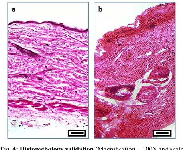 Figure 4 for Deep Learning based Skin-layer Segmentation for Characterizing Cutaneous Wounds from Optical Coherence Tomography Images