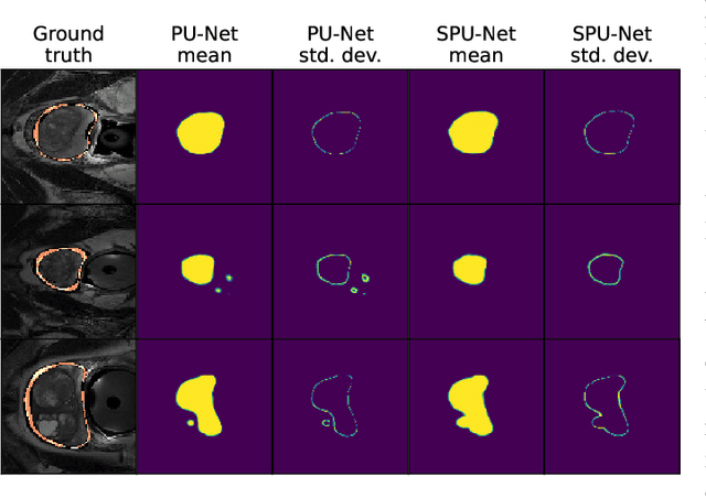 Figure 2 for Investigating and Improving Latent Density Segmentation Models for Aleatoric Uncertainty Quantification in Medical Imaging