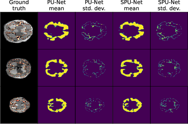 Figure 3 for Investigating and Improving Latent Density Segmentation Models for Aleatoric Uncertainty Quantification in Medical Imaging