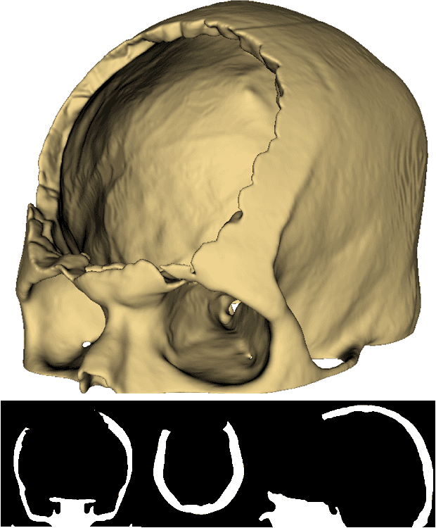 Figure 1 for Automatic Skull Reconstruction by Deep Learnable Symmetry Enforcement