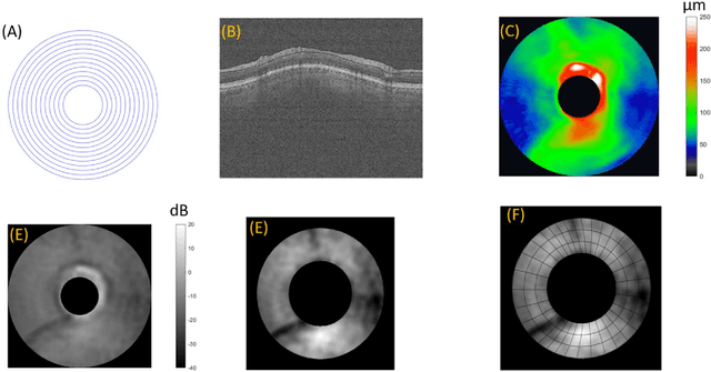 Figure 1 for A Hybrid Deep Learning Classification of Perimetric Glaucoma Using Peripapillary Nerve Fiber Layer Reflectance and Other OCT Parameters from Three Anatomy Regions