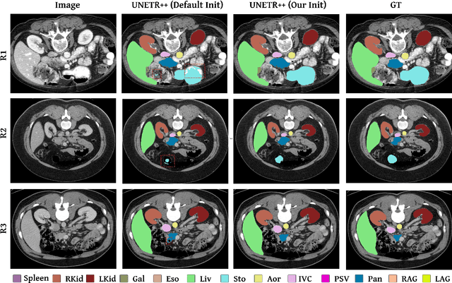 Figure 3 for Learnable Weight Initialization for Volumetric Medical Image Segmentation