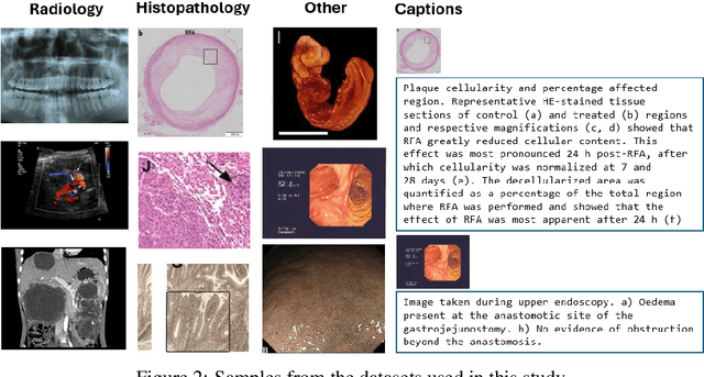 Figure 3 for Benchmarking Vision-Language Contrastive Methods for Medical Representation Learning