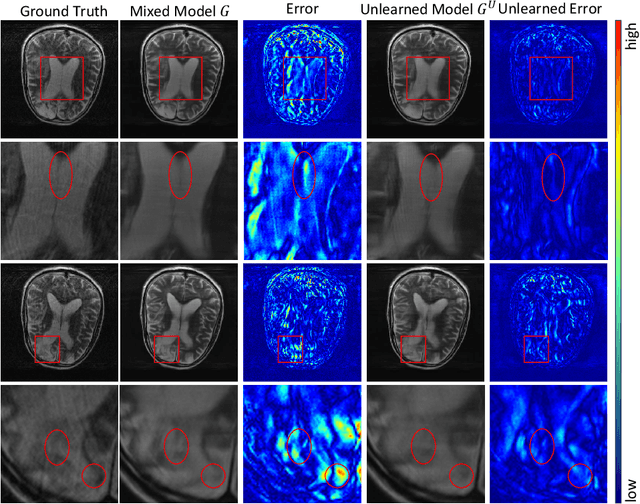 Figure 1 for Erase to Enhance: Data-Efficient Machine Unlearning in MRI Reconstruction