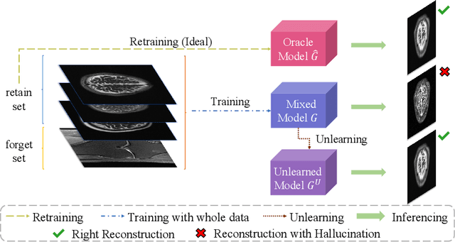 Figure 3 for Erase to Enhance: Data-Efficient Machine Unlearning in MRI Reconstruction