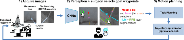 Figure 2 for Deep Learning Guided Autonomous Retinal Surgery using a Robotic Arm, Microscopy, and iOCT Imaging