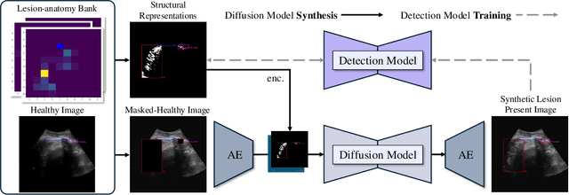 Figure 3 for Ultrasound Image Synthesis Using Generative AI for Lung Ultrasound Detection