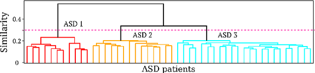 Figure 4 for EAG-RS: A Novel Explainability-guided ROI-Selection Framework for ASD Diagnosis via Inter-regional Relation Learning