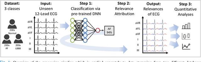 Figure 1 for Analysis of a Deep Learning Model for 12-Lead ECG Classification Reveals Learned Features Similar to Diagnostic Criteria