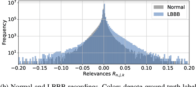 Figure 2 for Analysis of a Deep Learning Model for 12-Lead ECG Classification Reveals Learned Features Similar to Diagnostic Criteria