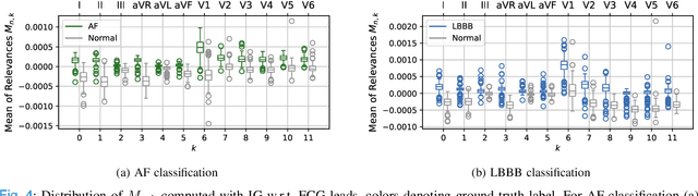 Figure 4 for Analysis of a Deep Learning Model for 12-Lead ECG Classification Reveals Learned Features Similar to Diagnostic Criteria