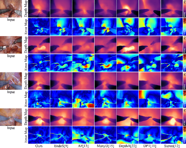 Figure 3 for Enhanced Scale-aware Depth Estimation for Monocular Endoscopic Scenes with Geometric Modeling