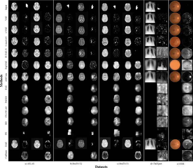 Figure 3 for Unsupervised Pathology Detection: A Deep Dive Into the State of the Art