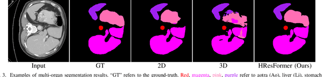 Figure 3 for HResFormer: Hybrid Residual Transformer for Volumetric Medical Image Segmentation