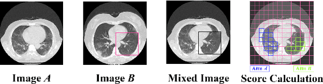 Figure 4 for Lung Infection Severity Prediction Using Transformers with Conditional TransMix Augmentation and Cross-Attention